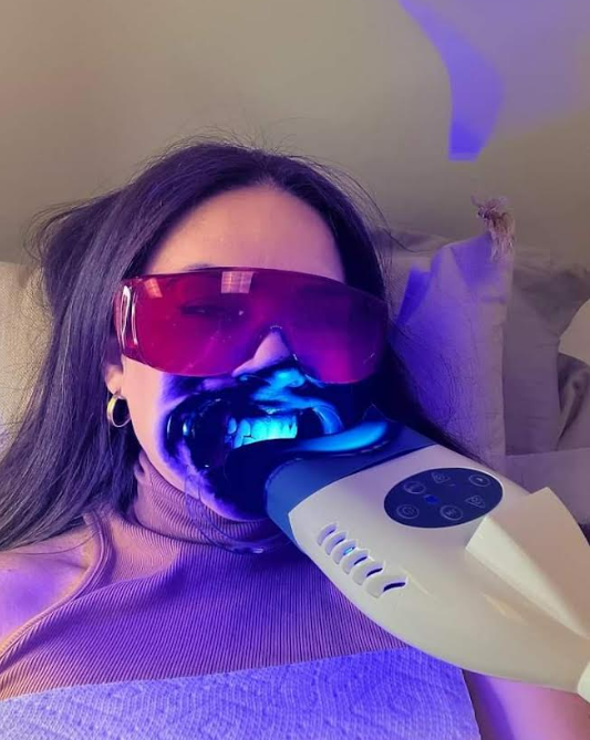 Teeth Whitening Results